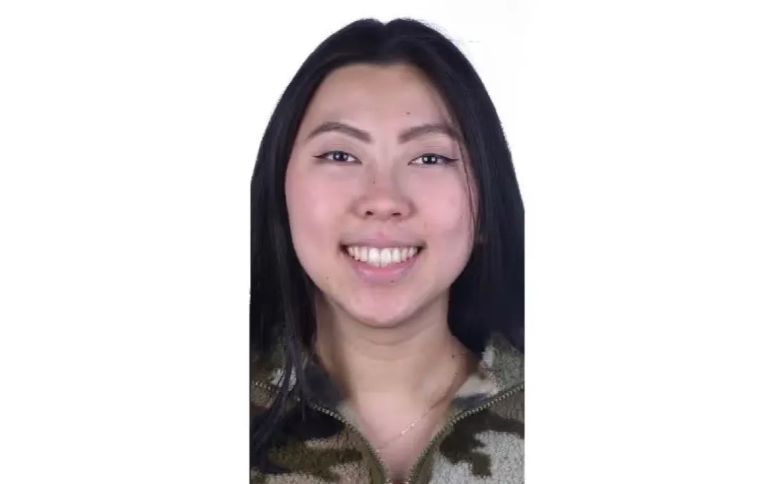 The same patient’s teeth after braces treatment