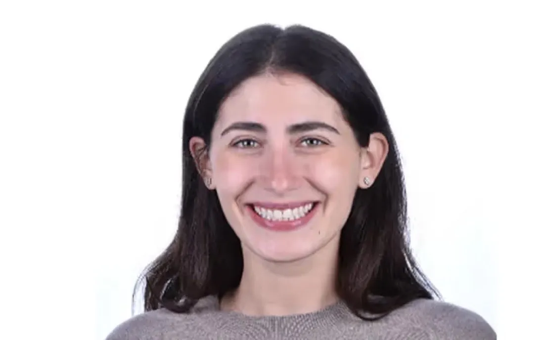 The same patient smiling straight to camera after braces treatment