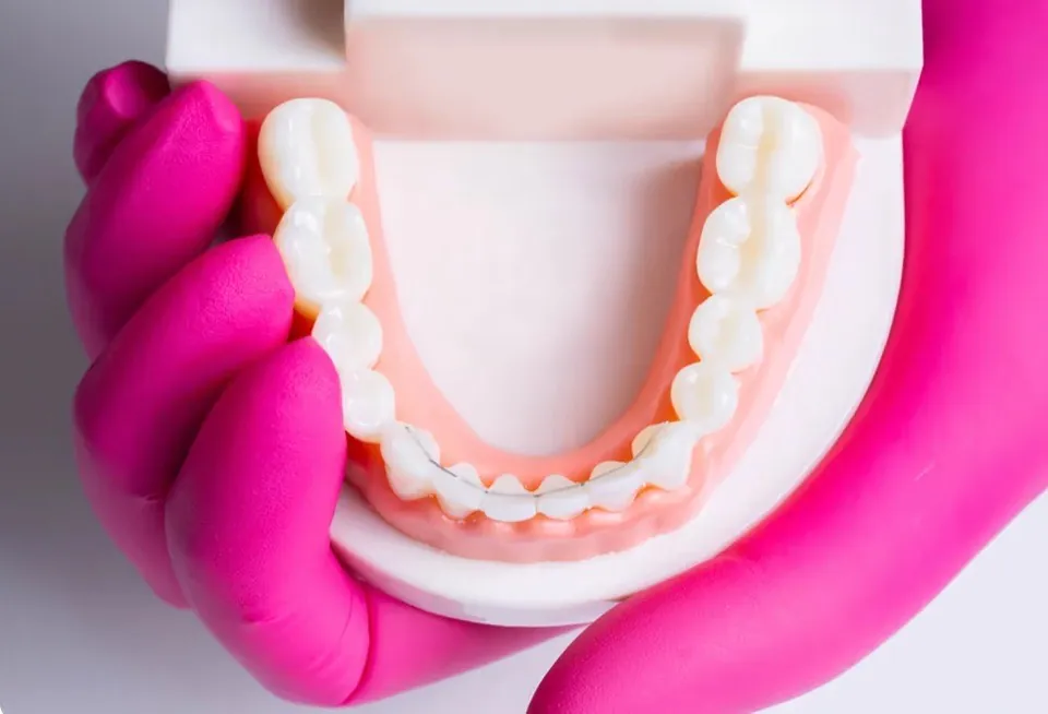 A gloved hand holding a dental arch model seen from above, with nothing fitted to the outward-facing surfaces of the teeth