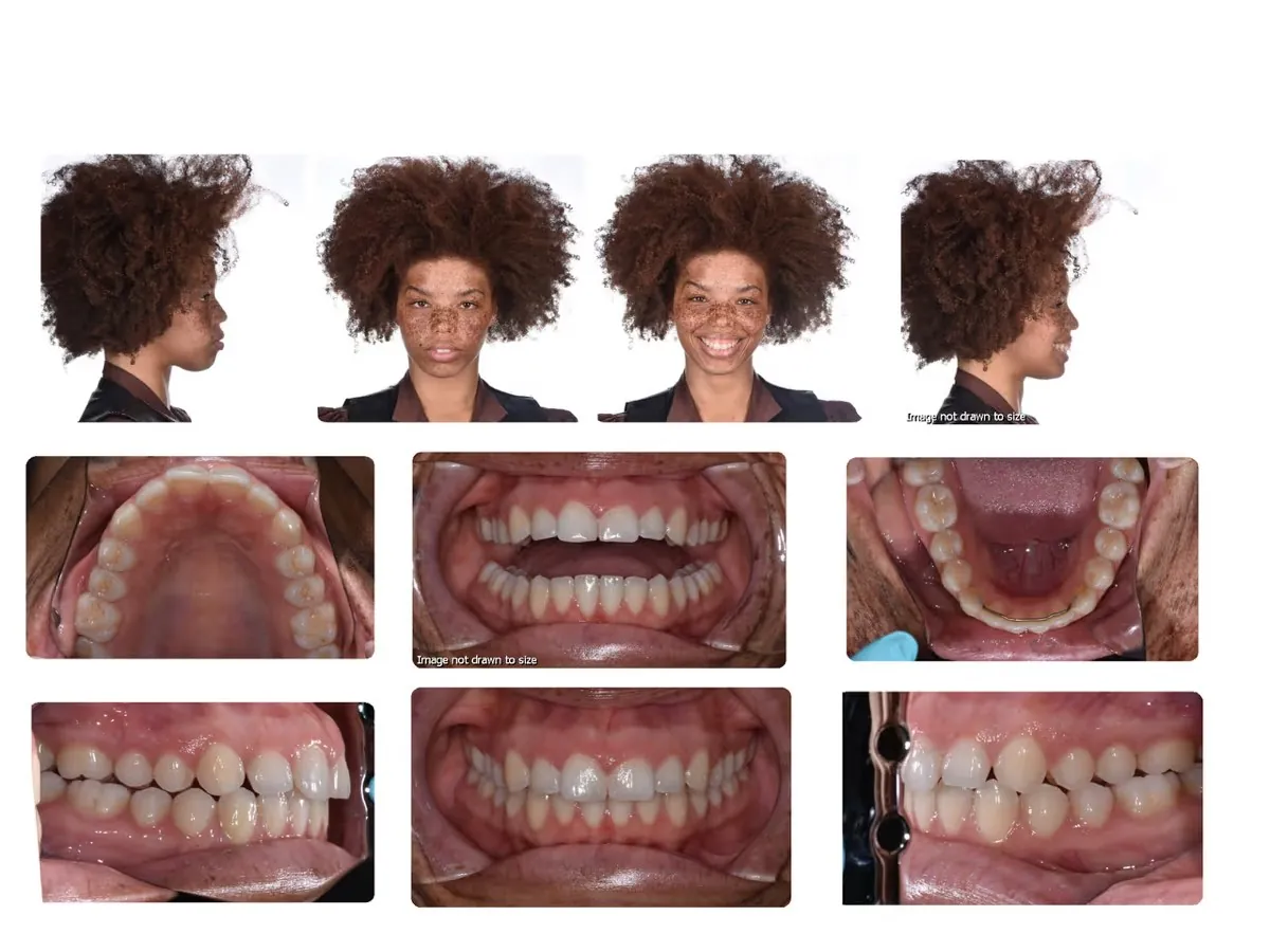 A complete orthodontic photo set: four facial views — right profile, front relaxed, front smiling, left profile — above six views inside the mouth showing the upper arch, the front bite, the lower arch, and both sides